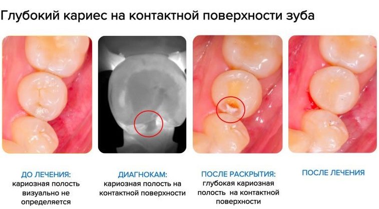 детский стоматолог спб